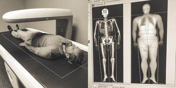 Does this scan make me look fat?